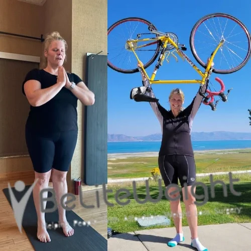 Weight Loss Surgery Before And After